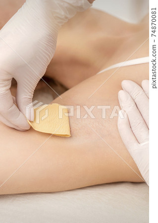 Beautician waxing young female armpit 74870081