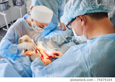 Doctor and assistant doing abdominoplasty or tummy tuck surgery. 74879164