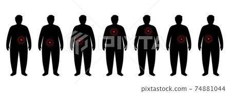 Organs in obese human body 74881044