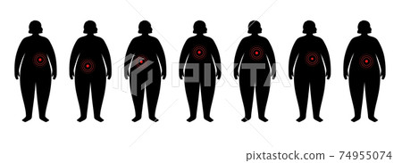 Organs in obese human body Organs in obese human body 74955074