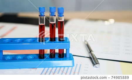 Test tubes on a stand and a flask with red blood on medical documents Test tubes on a stand and a flask with red blood on medical documents 74985889