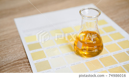 A flask with urine. Medical analyzes concept. Diagnostics by the color of urine 74986016