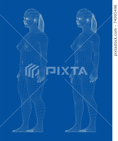 Fat and slim woman, before and after weight loss Fat and slim woman, before and after weight loss 74995496