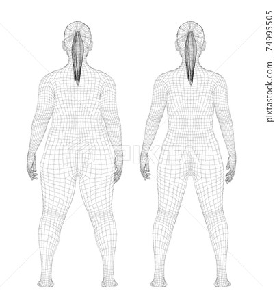 Fat and slim woman, before and after weight loss 74995505