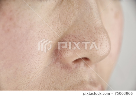 女人的皮膚煩了 女人的皮膚煩了 75003966