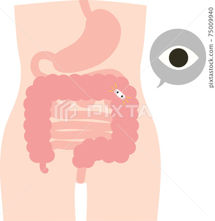 膠囊型結腸相機檢查 膠囊型結腸相機檢查 75009940