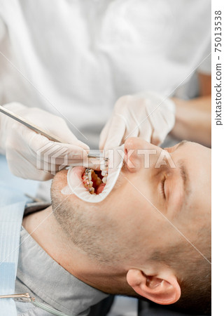 Patient with dental braces during a regular orthodontic visit Patient with dental braces during a regular orthodontic visit 75013538