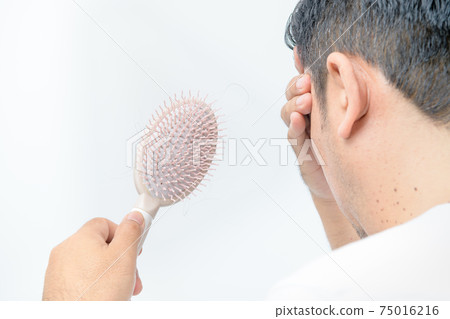 Middle-aged man shows  comb brush with loss hair and stressed about his hair loss problems 75016216