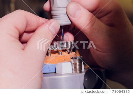 The process of making a dental prosthesis in a dental laboratory. The process of making a dental prosthesis in a dental laboratory. 75064585