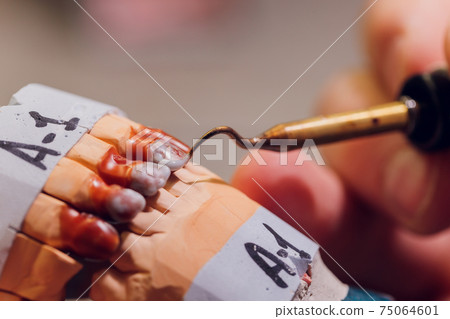 The process of making a dental prosthesis in a dental laboratory. The process of making a dental prosthesis in a dental laboratory. 75064601