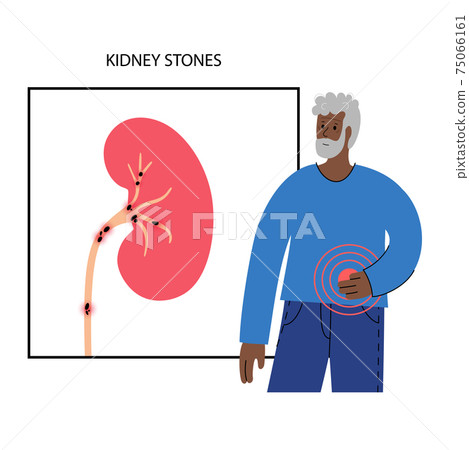 Kidney disease concept 75066161