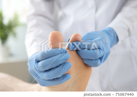 Gloved doctor examines patient's skin on leg between toes Gloved doctor examines patient's skin on leg between toes 75067440