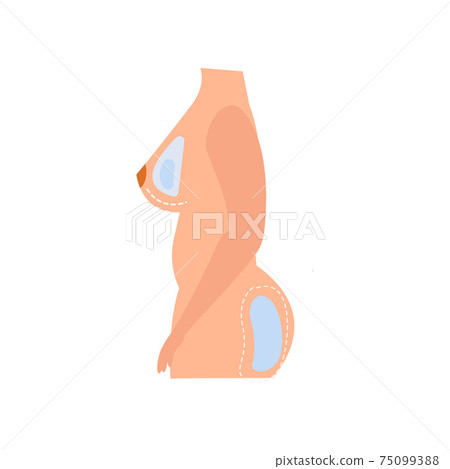 Ass Breast Augmentation Composition Ass Breast Augmentation Composition 75099388