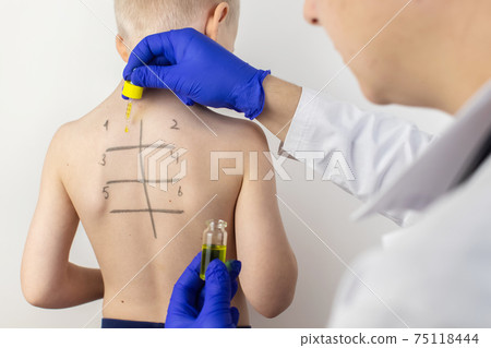 An allergist in the laboratory conducts an allergy prick-test. Skin test for household, food, epidermal allergic reactions. The test is performed on the patient's back. Child at a doctor's appointment 75118444