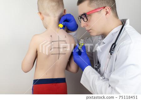 An allergist in the laboratory conducts an allergy prick-test. Skin test for household, food, epidermal allergic reactions. The test is performed on the patient's back. Child at a doctor's appointment An allergist in the laboratory conducts an allergy prick-test. Skin test for household, food, epidermal allergic reactions. The test is performed on the patient's back. Child at a doctor's appointment 75118451