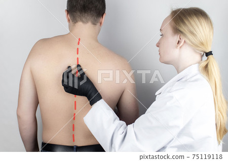 A man at the doctor's appointment with back pain. Treatment of spinal deformity and stoop. Osteoporosis, kyphosis, lordosis, or scoliosis. A man at the doctor's appointment with back pain. Treatment of spinal deformity and stoop. Osteoporosis, kyphosis, lordosis, or scoliosis. 75119118