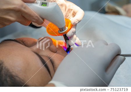 Close up photo of woman having dental ultraviolet light treatment 75123719