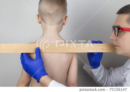 A little boy at the doctor's appointment with back pain. Treatment of spinal deformity and stoop. Osteoporosis, kyphosis, lordosis, or scoliosis. 75156147