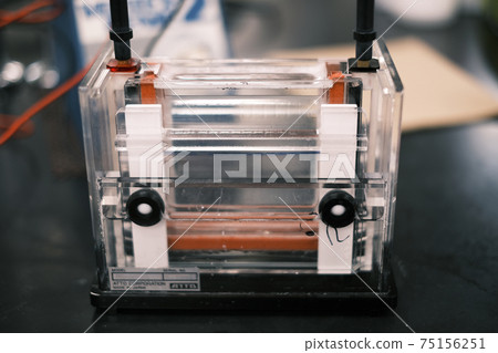 Protein electrophoresis 04 75156251