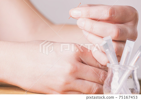 Needeling Acupuncture Needeling Acupuncture 75167453