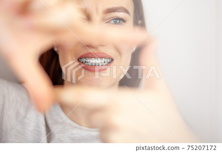 A girl with braces on her white teeth through a frame from her hands. 75207172