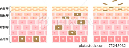 周轉機理皮膚橫斷面圖 75248082