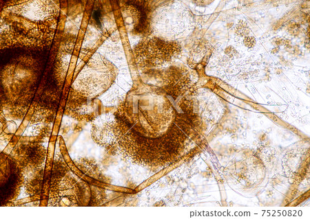 Characteristics of Rhizopus is a genus of common saprophytic fungi on Slide under the microscope for education. Characteristics of Rhizopus is a genus of common saprophytic fungi on Slide under the microscope for education. 75250820