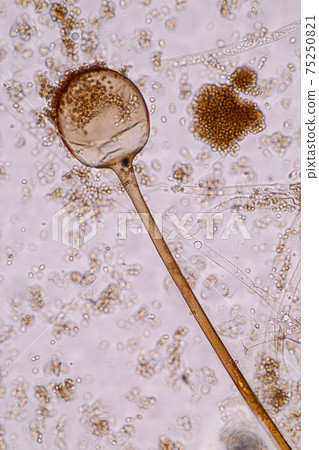 Characteristics of Rhizopus is a genus of common saprophytic fungi on Slide under the microscope for education. Characteristics of Rhizopus is a genus of common saprophytic fungi on Slide under the microscope for education. 75250821