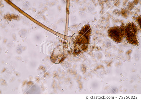Characteristics of Rhizopus is a genus of common saprophytic fungi on Slide under the microscope for education. 75250822