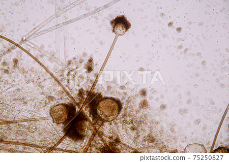 Characteristics of Rhizopus is a genus of common saprophytic fungi on Slide under the microscope for education. Characteristics of Rhizopus is a genus of common saprophytic fungi on Slide under the microscope for education. 75250827
