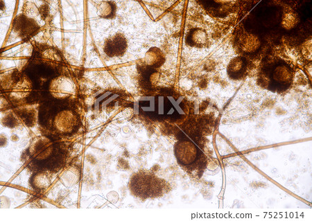 Characteristics of Rhizopus is a genus of common saprophytic fungi on Slide under the microscope for education. Characteristics of Rhizopus is a genus of common saprophytic fungi on Slide under the microscope for education. 75251014