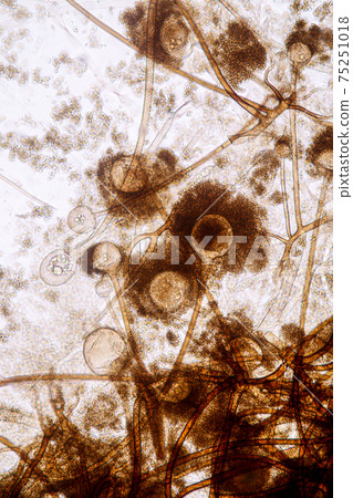 Characteristics of Rhizopus is a genus of common saprophytic fungi on Slide under the microscope for education. Characteristics of Rhizopus is a genus of common saprophytic fungi on Slide under the microscope for education. 75251018