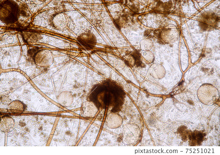 Characteristics of Rhizopus is a genus of common saprophytic fungi on Slide under the microscope for education. Characteristics of Rhizopus is a genus of common saprophytic fungi on Slide under the microscope for education. 75251021