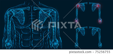 Human anatomical model. Pain, injury and inflammation of the shoulder and elbow joints front view polygonal illustration on a blue background. Healthy and sore joints. 75256755
