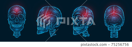 Pain, injury or inflammation of the skull bones polygonal vector illustration. Low poly model of a human skull 75256756