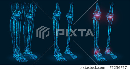 Pain, injury or inflammation in the knees and ankles polygonal vector illustration. Low poly model of diseased knee and ankle joints. Pain, injury or inflammation in the knees and ankles polygonal vector illustration. Low poly model of diseased knee and ankle joints. 75256757