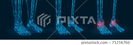 Pain, injury or inflammation of the ankle joint polygonal vector illustration. Low poly model of human feet. Pain, injury or inflammation of the ankle joint polygonal vector illustration. Low poly model of human feet. 75256760