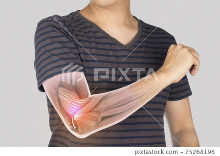 x-ray elbow muscle injury 75268198