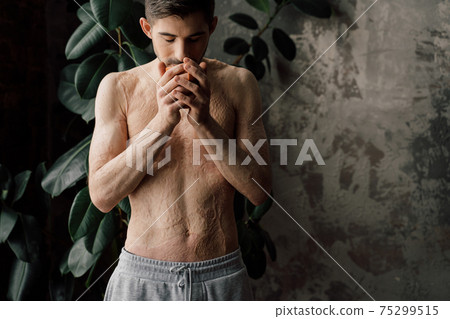 Man with scars at the skin after burn enjoying his coffee while being at home Man with scars at the skin after burn enjoying his coffee while being at home 75299515