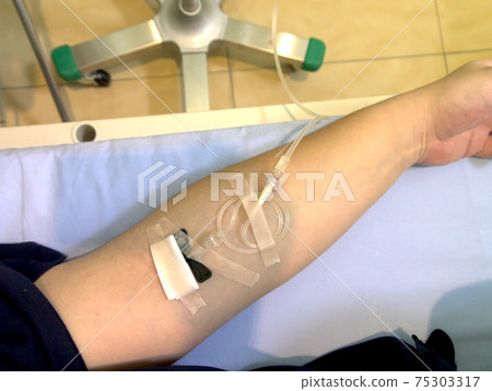 靜脈滴注 75303317