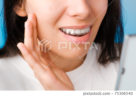 Cheerful young woman watching into the mirror in transparent aligners for straightening and whitening teeth. Removable braces for correction of bite Cheerful young woman watching into the mirror in transparent aligners for straightening and whitening teeth. Removable braces for correction of bite 75306540