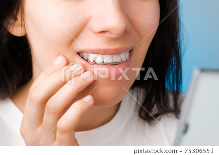 Cheerful young woman watching into the mirror in transparent aligners for straightening and whitening teeth. Removable braces for correction of bite Cheerful young woman watching into the mirror in transparent aligners for straightening and whitening teeth. Removable braces for correction of bite 75306551