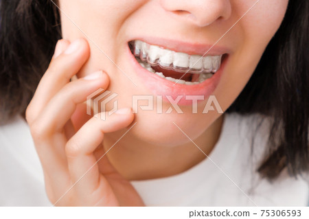 Cheerful young woman watching into the mirror in transparent aligners for straightening and whitening teeth. Removable braces for correction of bite Cheerful young woman watching into the mirror in transparent aligners for straightening and whitening teeth. Removable braces for correction of bite 75306593