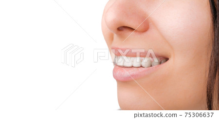 A side view of a womans smile in transparent and removable aligners with copy space. 75306637