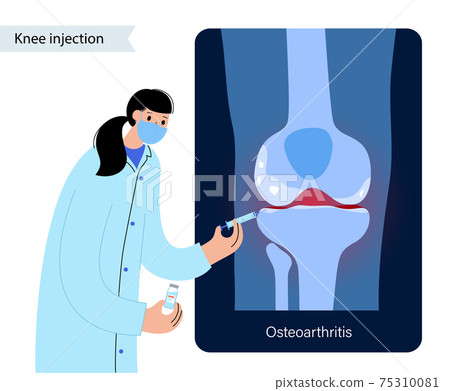 Knee Injection treatment 75310081