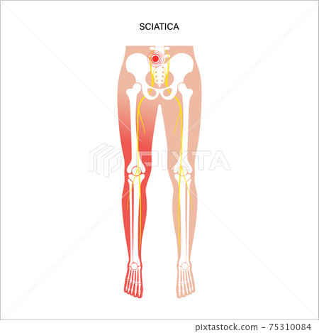 Pelvis bones and muscle  75310084