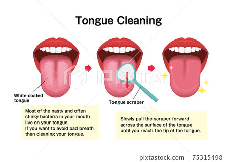 How To Brush And Clean Your Tongue Vector... - Stock Illustration ...