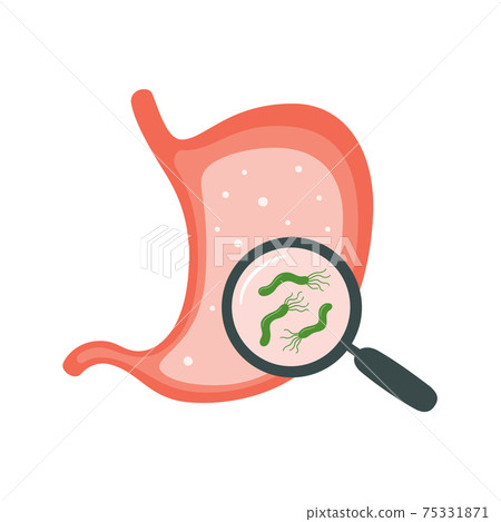 Helicobacter Pylori in the stomach. Stomach diseases. Bacterium with flagella that causes gastritis. 75331871