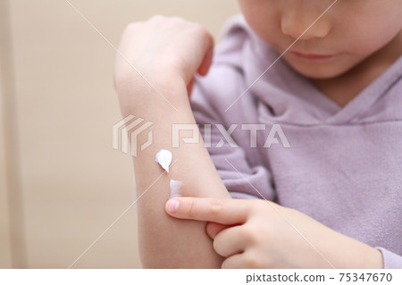 A child's finger that applies an ointment to the arm 75347670