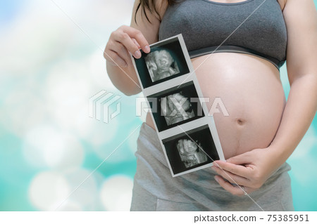 pregnant woman holding an ultrasound picture pregnant woman holding an ultrasound picture 75385951